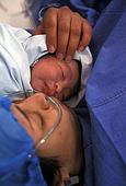 ► Что это такое — субинволюция матки после родов? Представляем причины, лечение послеродовой субинволюции матки!