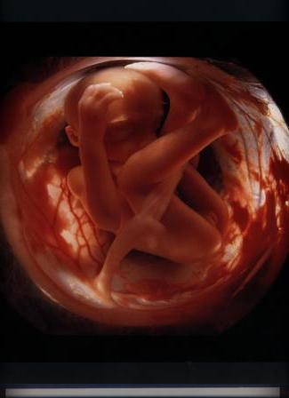 беременность фото развития плода