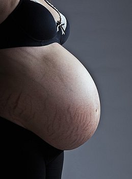 ► Как предотвратить появление растяжек на животе при беременности в домашних условиях?