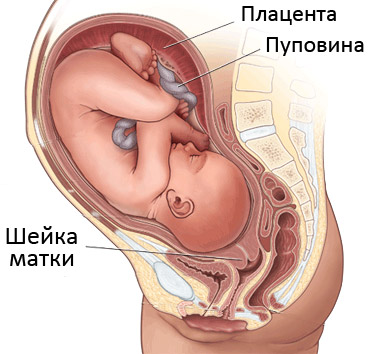 ► Короткая шейка матки при беременности: лечение