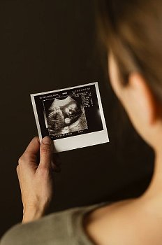 ► Что смотрят на УЗИ на 22 неделе беременности