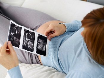 ► На каких сроках делают 1, 2, 3 УЗИ во время беременности? Сколько раз можно делать УЗИ при беременности?