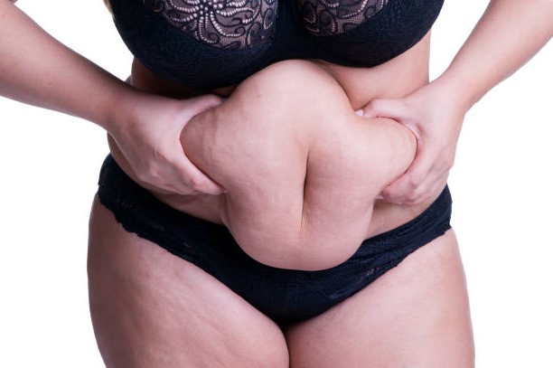 ► 7 причин, из-за которых не удается похудеть в животе