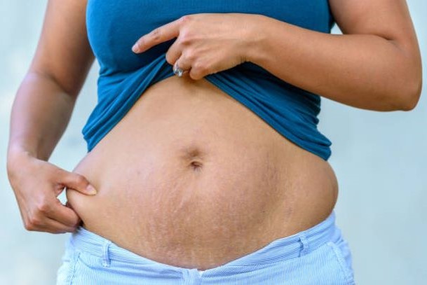 ► Советы для быстрого похудения после родов