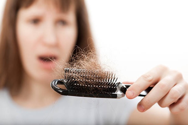 ► 9 способов остановить выпадение волос